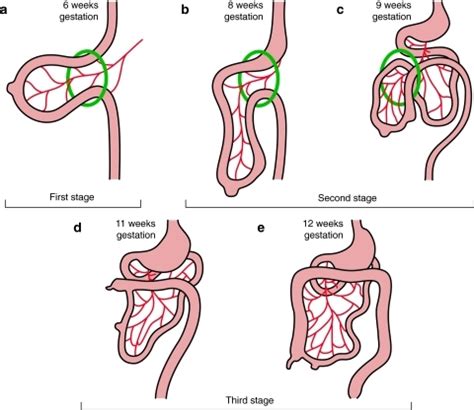 traduction bowel|bowel loops in spanish.